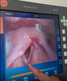 Imagen4